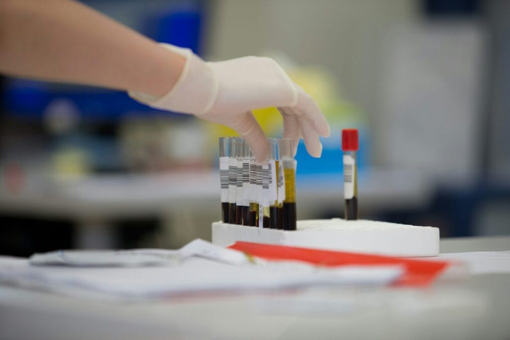 Tubos con muestras de sangre materna en el laboratorio para analizar ADN fetal libre
